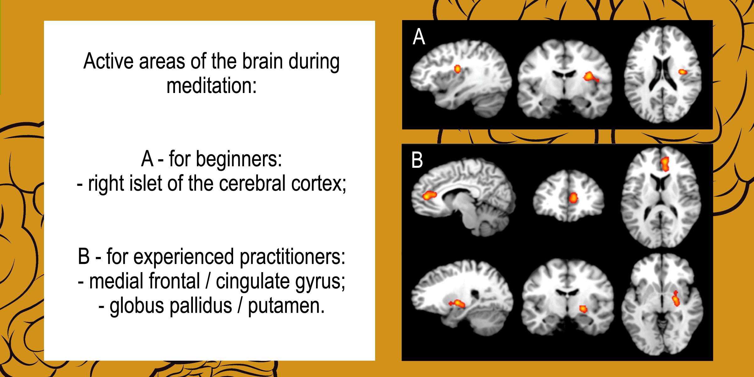 Areas of the brain